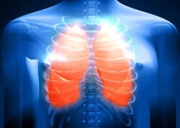 neoplasia pulmonar, tumor pulmonar, doença oncológica pulmonar;